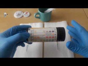 ph urine 7.5 cosa significa.